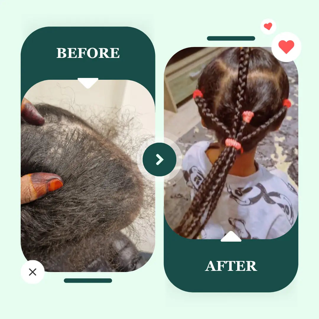 Women Hair Growth Set | 100% pure organic