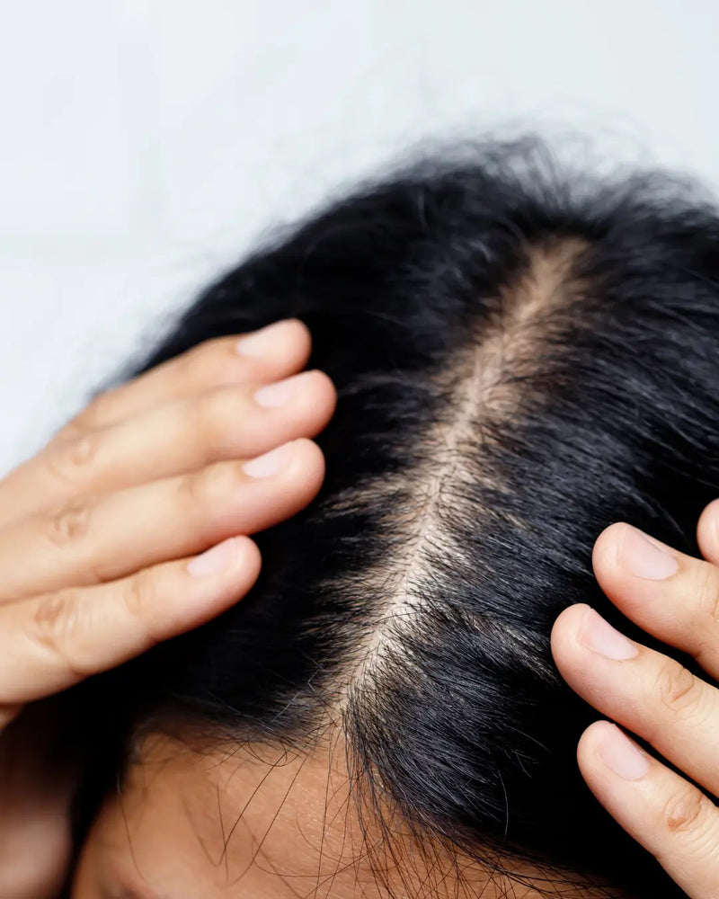 Reduction in dandruff and eczema