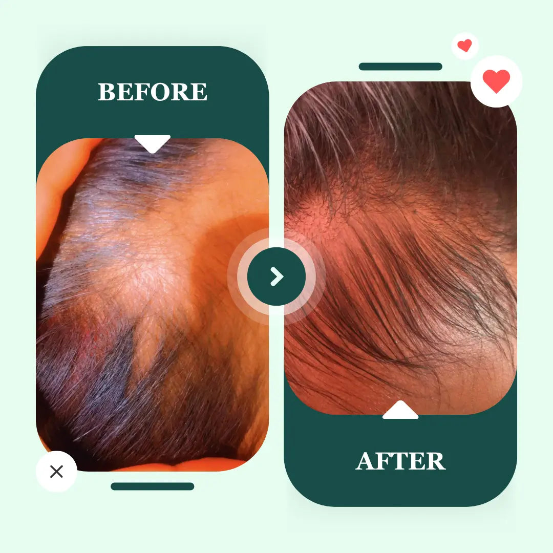 Women Hair Growth Set | 100% pure organic