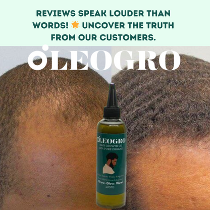 Men Hair Growth oil | 100% Pure Organic